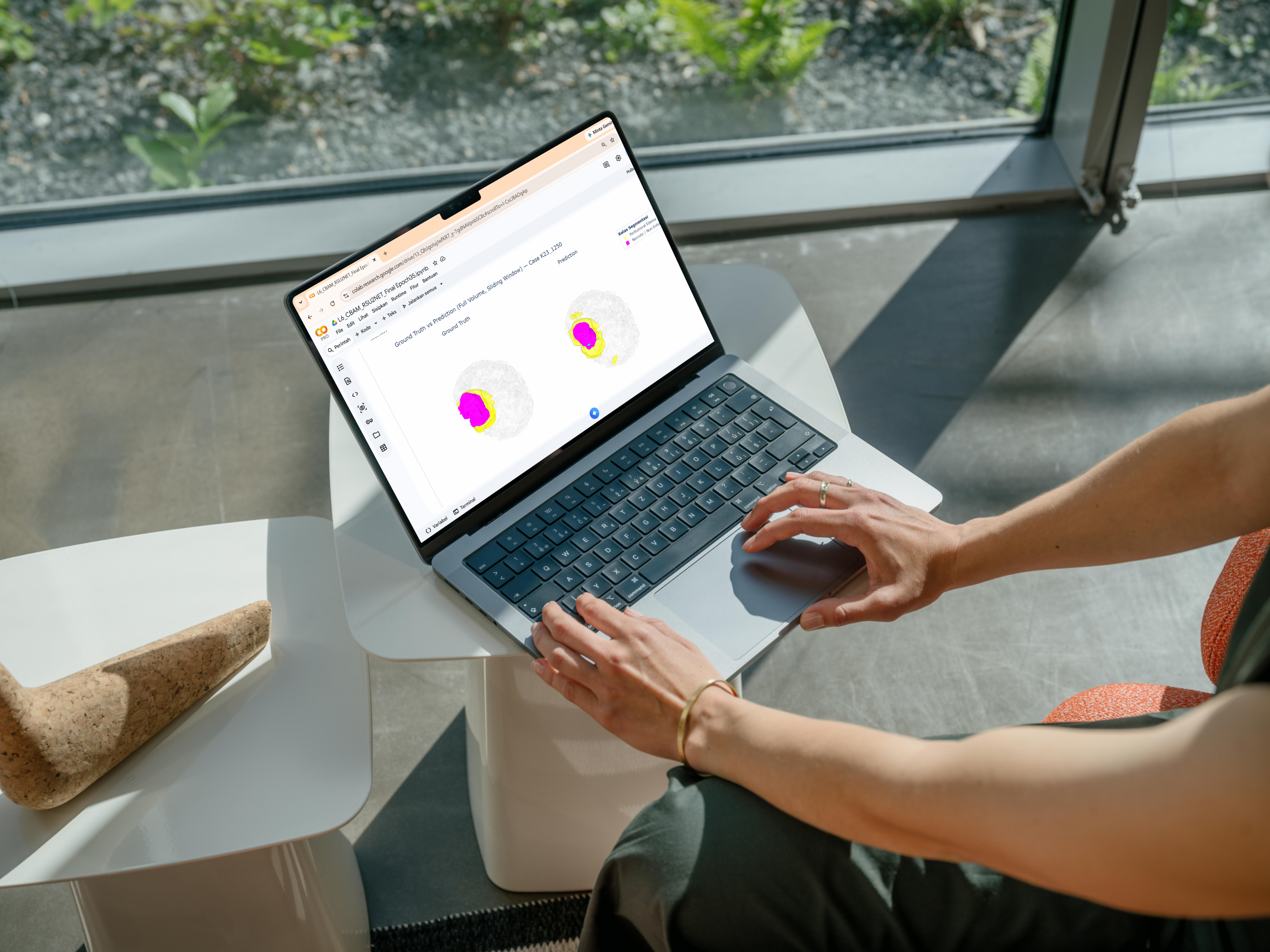 Optimisasi Konfigurasi RSU2-Net Berbasis Attention via Taguchi